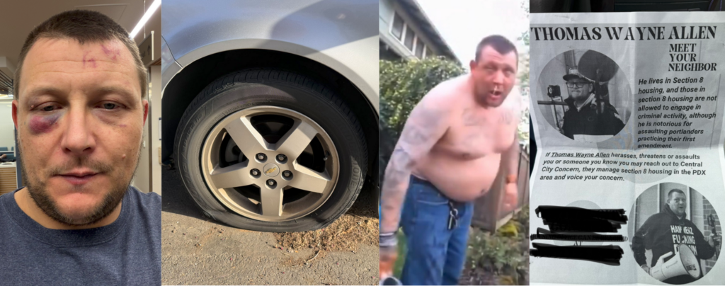 4 photos.
1 - Tommy with a black eye and bruising on his face
2 - A deflated tire
3 - Tommy shirtless and drooling, with his eyes struggling to stay open after being maced.
4 - Flyer about Tommy, urging people to call Central City Concern because he is taking up a Section 8 apartment while spending his dayts assaulting people.